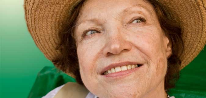 age spots face