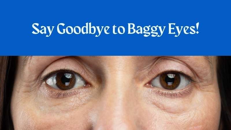 Home Remedies for Baggy Eyes